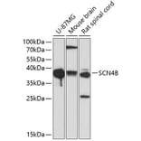 Western Blot - Anti-SCN4B Antibody (A9000) - Antibodies.com
