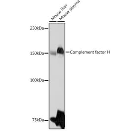 Western Blot - Anti-Factor H Antibody (A9001) - Antibodies.com