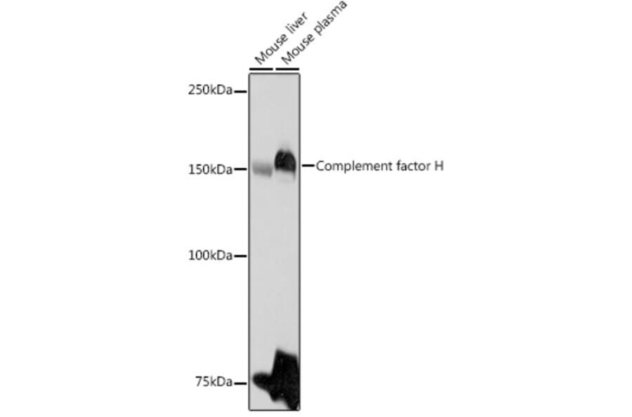 Western Blot - Anti-Factor H Antibody (A9001) - Antibodies.com