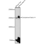 Western Blot - Anti-Factor H Antibody (A9001) - Antibodies.com