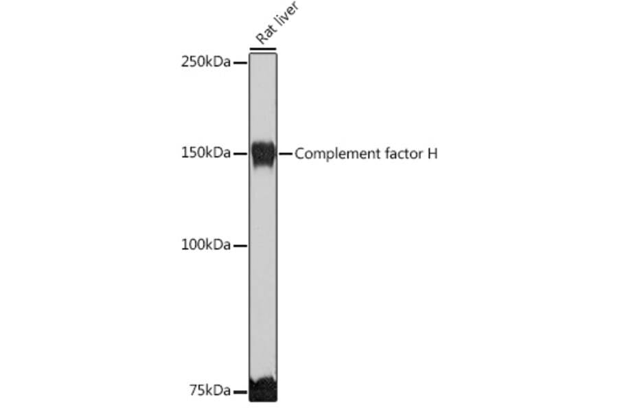 Western Blot - Anti-Factor H Antibody (A9001) - Antibodies.com