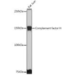 Western Blot - Anti-Factor H Antibody (A9001) - Antibodies.com