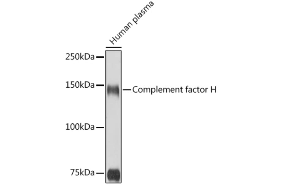 Western Blot - Anti-Factor H Antibody (A9001) - Antibodies.com