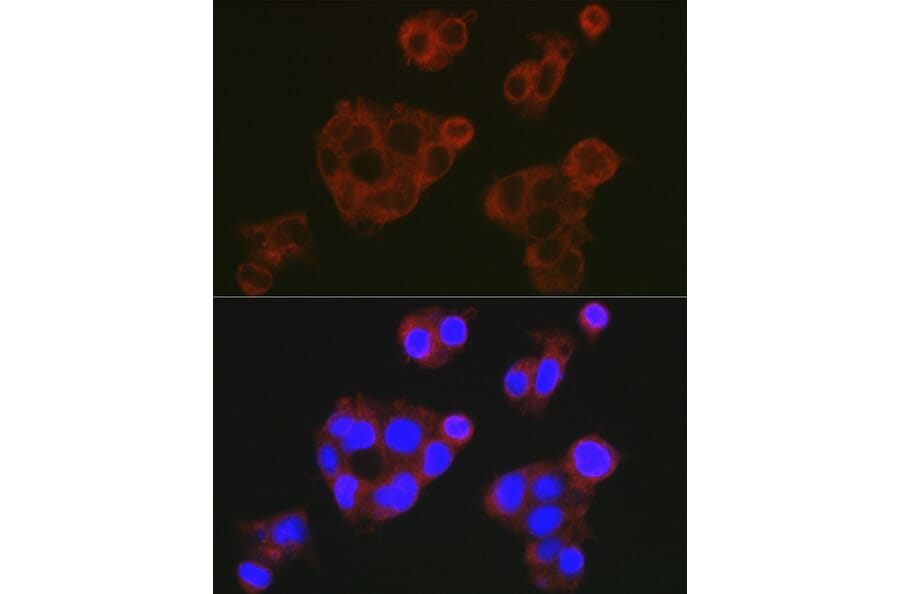 Immunofluorescence - Anti-Factor H Antibody (A9001) - Antibodies.com