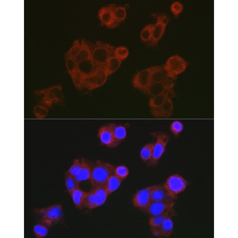 Immunofluorescence - Anti-Factor H Antibody (A9001) - Antibodies.com