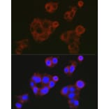 Immunofluorescence - Anti-Factor H Antibody (A9001) - Antibodies.com