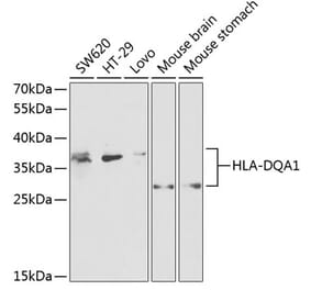 Western Blot - Anti-HLA-DQA1 Antibody (A9002) - Antibodies.com