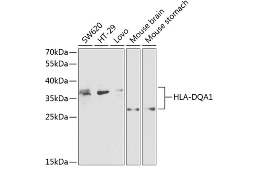 Western Blot - Anti-HLA-DQA1 Antibody (A9002) - Antibodies.com