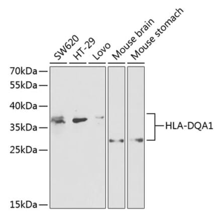 Western Blot - Anti-HLA-DQA1 Antibody (A9002) - Antibodies.com