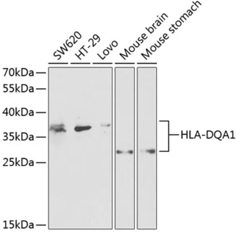 Western Blot - Anti-HLA-DQA1 Antibody (A9002) - Antibodies.com