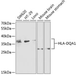 Western Blot - Anti-HLA-DQA1 Antibody (A9002) - Antibodies.com