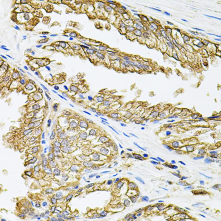 Immunohistochemistry - Anti-HLA-DQA1 Antibody (A9002) - Antibodies.com