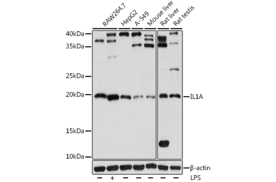 Western Blot - Anti-IL-1 alpha Antibody (A9003) - Antibodies.com