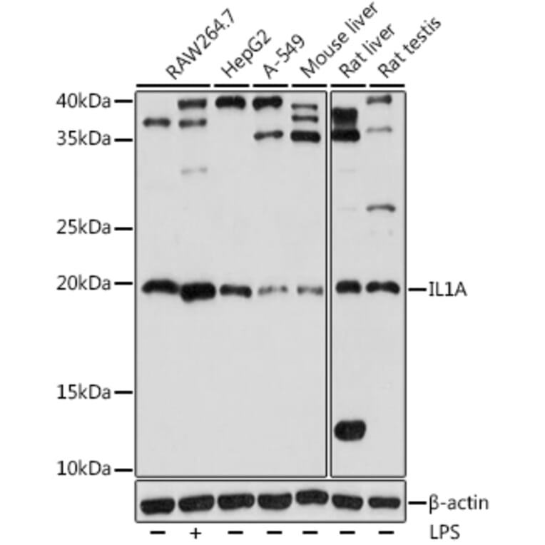 Western Blot - Anti-IL-1 alpha Antibody (A9003) - Antibodies.com