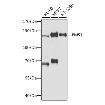 Western Blot - Anti-PMS1 Antibody (A9004) - Antibodies.com