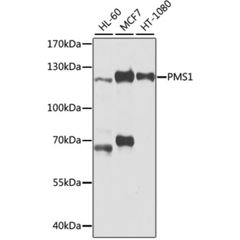 Western Blot - Anti-PMS1 Antibody (A9004) - Antibodies.com