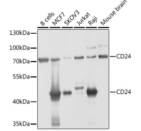 Western Blot - Anti-CD24 Antibody (A9005) - Antibodies.com
