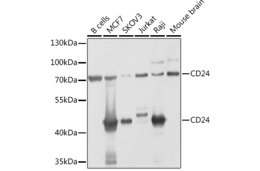 Western Blot - Anti-CD24 Antibody (A9005) - Antibodies.com