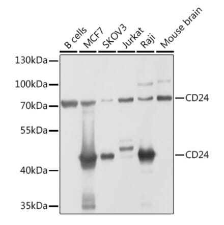 Western Blot - Anti-CD24 Antibody (A9005) - Antibodies.com