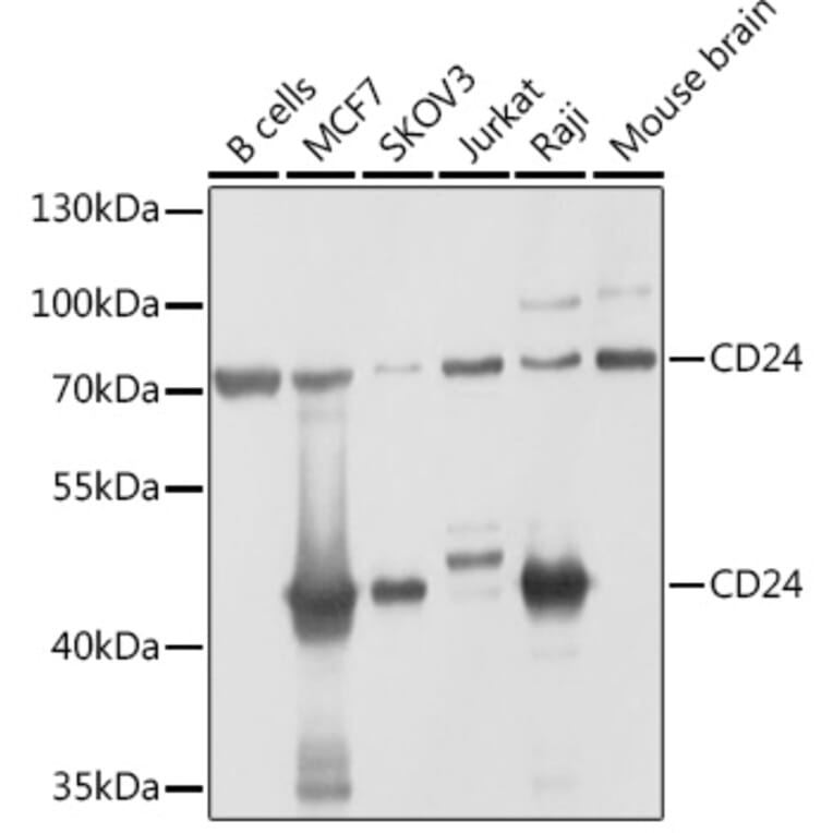 Western Blot - Anti-CD24 Antibody (A9005) - Antibodies.com