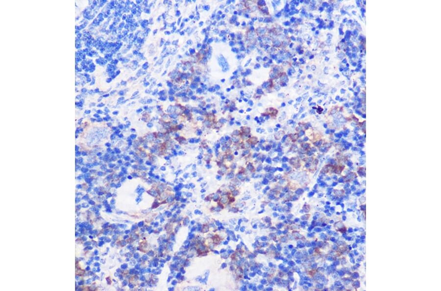 Immunohistochemistry - Anti-CD24 Antibody (A9005) - Antibodies.com