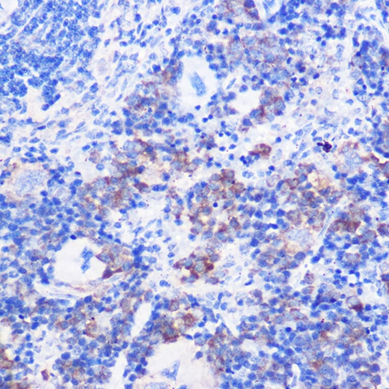 Immunohistochemistry - Anti-CD24 Antibody (A9005) - Antibodies.com