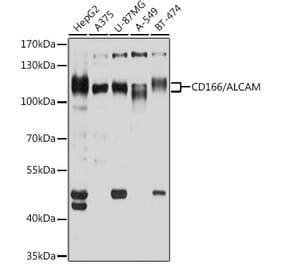 Western Blot - Anti-CD166 Antibody (A9007) - Antibodies.com
