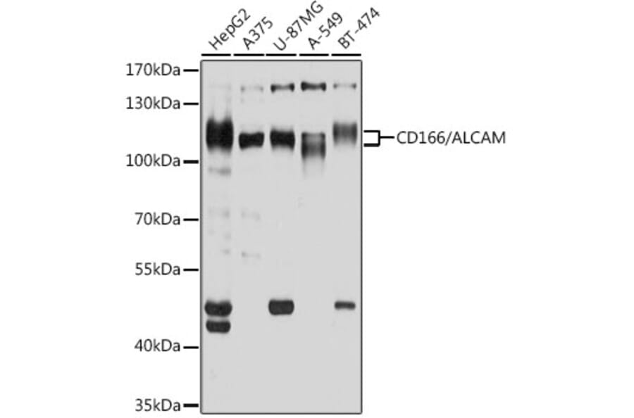 Western Blot - Anti-CD166 Antibody (A9007) - Antibodies.com