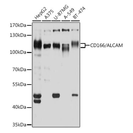 Western Blot - Anti-CD166 Antibody (A9007) - Antibodies.com