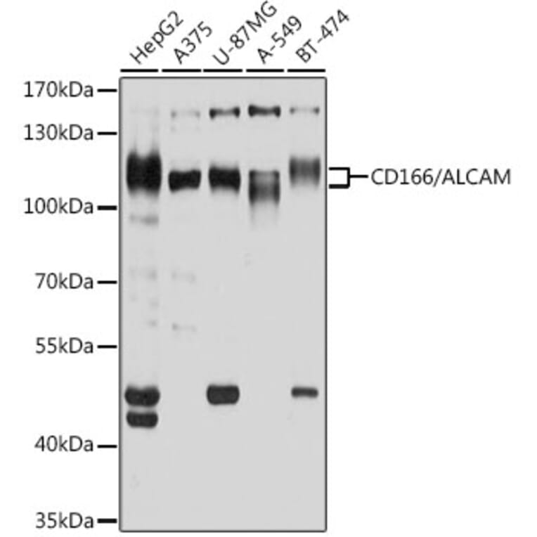 Western Blot - Anti-CD166 Antibody (A9007) - Antibodies.com