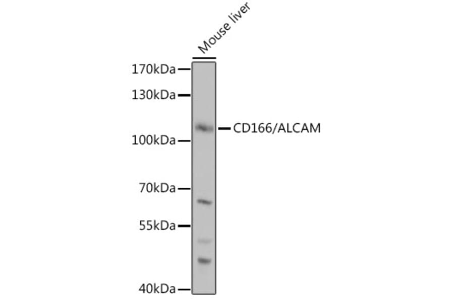 Western Blot - Anti-CD166 Antibody (A9007) - Antibodies.com