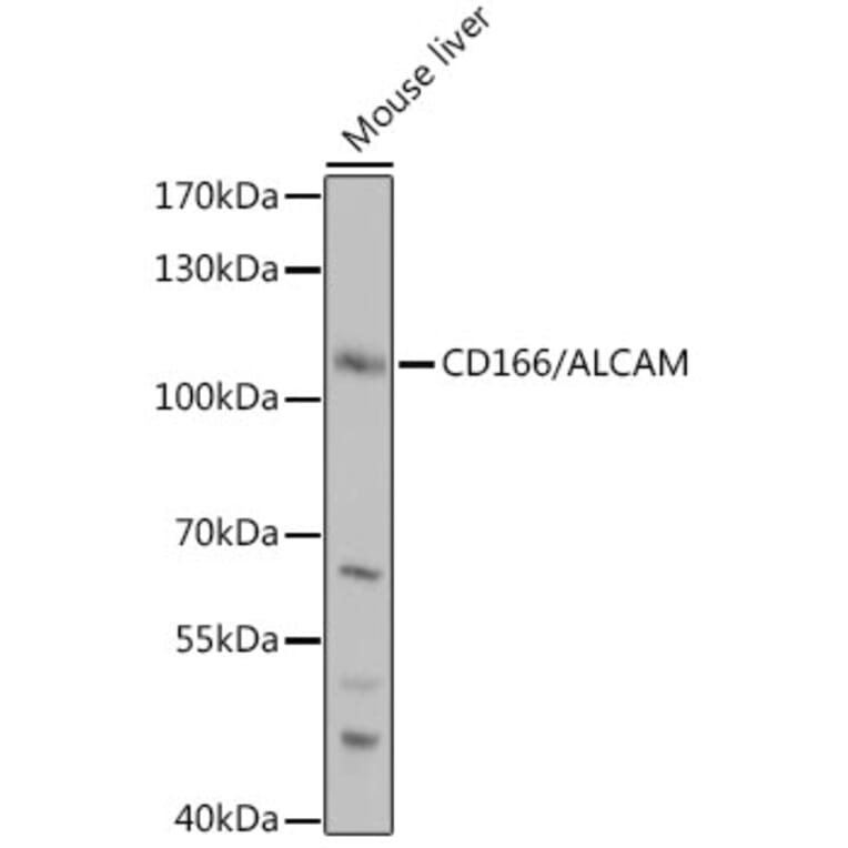 Western Blot - Anti-CD166 Antibody (A9007) - Antibodies.com