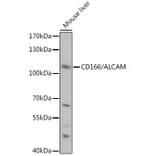 Western Blot - Anti-CD166 Antibody (A9007) - Antibodies.com