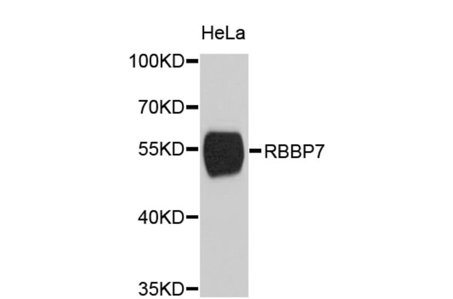 Western Blot - Anti-RBBP7 Antibody (A2229) - Antibodies.com