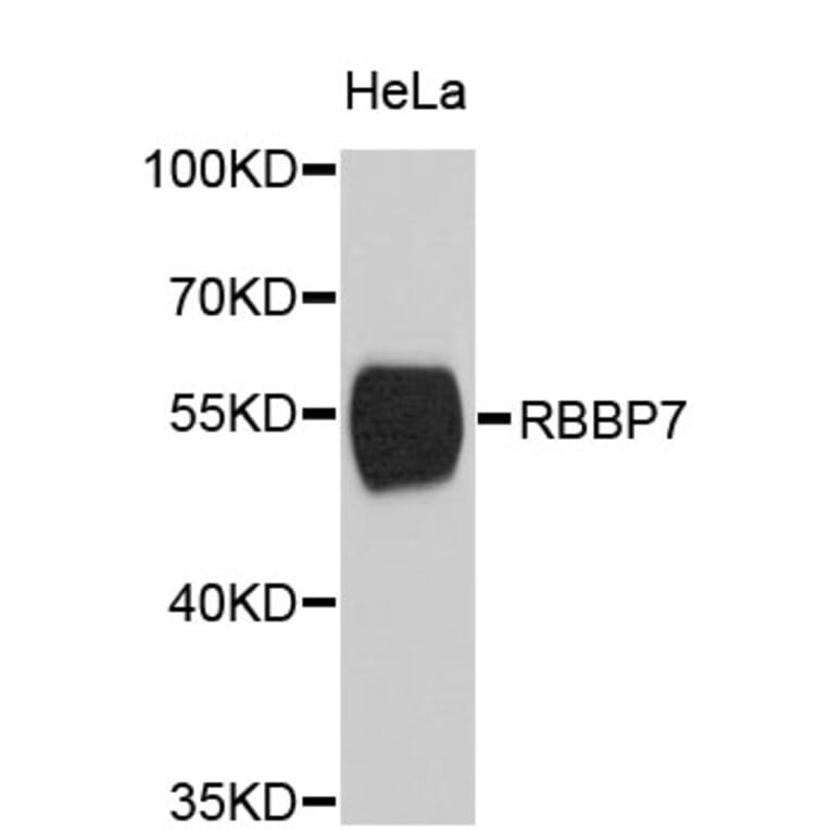 Western Blot - Anti-RBBP7 Antibody (A2229) - Antibodies.com