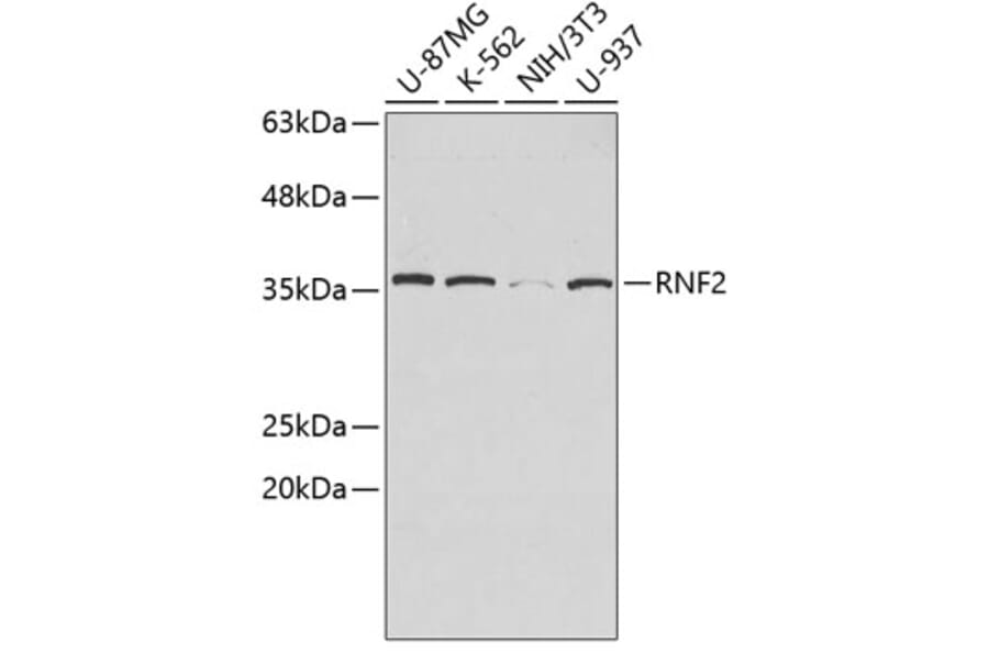 Western Blot - Anti-RNF2 Antibody (A2232) - Antibodies.com