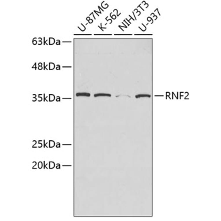 Western Blot - Anti-RNF2 Antibody (A2232) - Antibodies.com