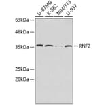 Western Blot - Anti-RNF2 Antibody (A2232) - Antibodies.com