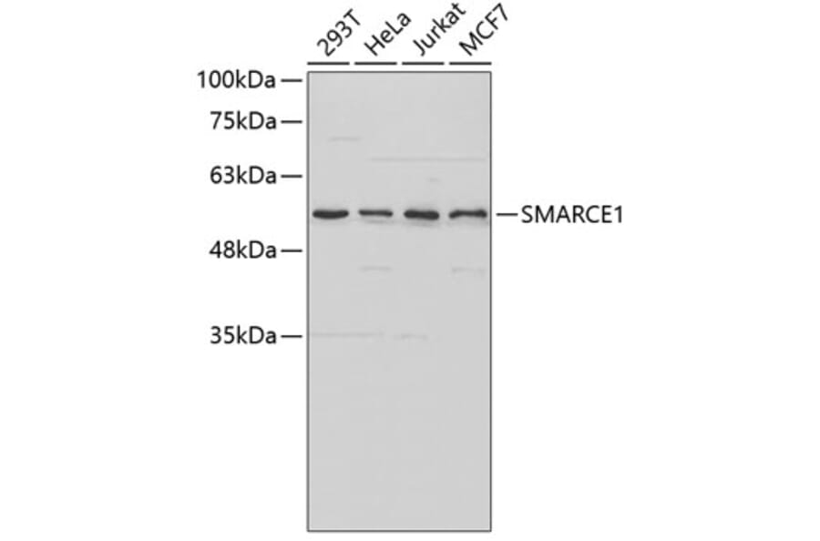 Western Blot - Anti-SMARCE1 Antibody (A2236) - Antibodies.com