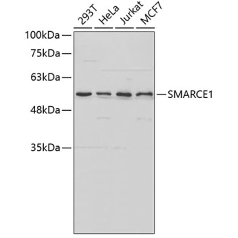 Western Blot - Anti-SMARCE1 Antibody (A2236) - Antibodies.com