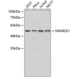Western Blot - Anti-SMARCE1 Antibody (A2236) - Antibodies.com