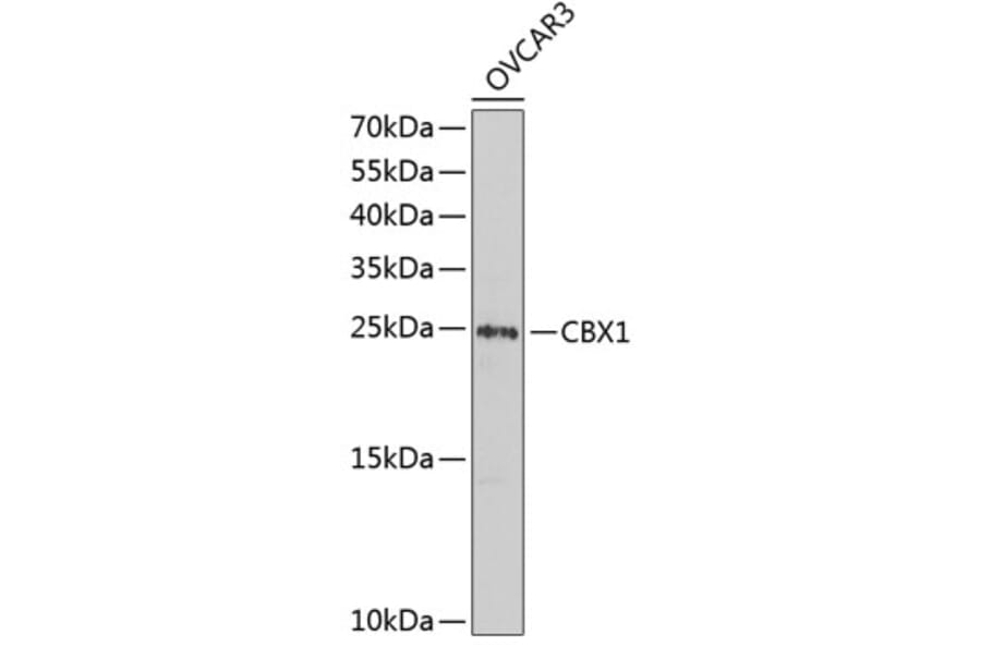 Western Blot - Anti-CBX1/HP1 beta Antibody (A9014) - Antibodies.com