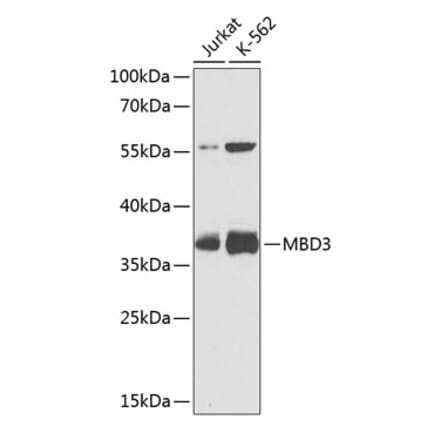 Western Blot - Anti-MBD3 Antibody (A9015) - Antibodies.com
