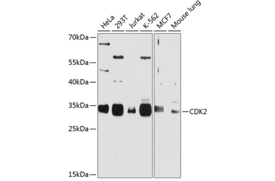 Western Blot - Anti-CDK2 Antibody (A2254) - Antibodies.com