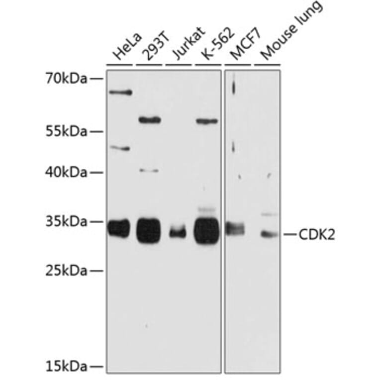 Western Blot - Anti-CDK2 Antibody (A2254) - Antibodies.com