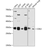 Western Blot - Anti-CDK2 Antibody (A2254) - Antibodies.com
