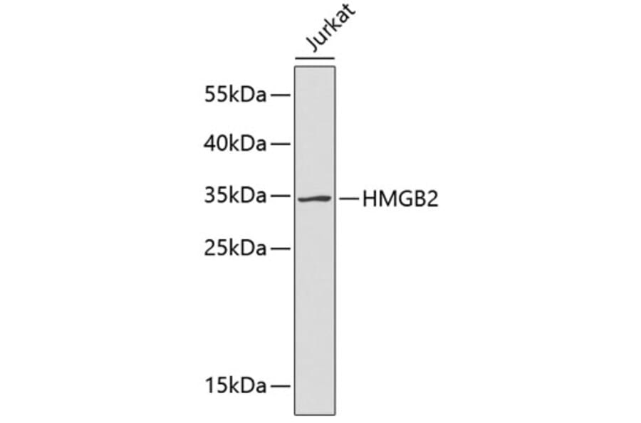 Western Blot - Anti-HMGB2 Antibody (A2260) - Antibodies.com