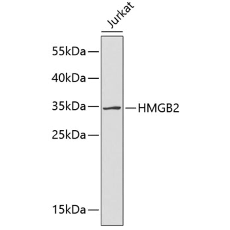 Western Blot - Anti-HMGB2 Antibody (A2260) - Antibodies.com