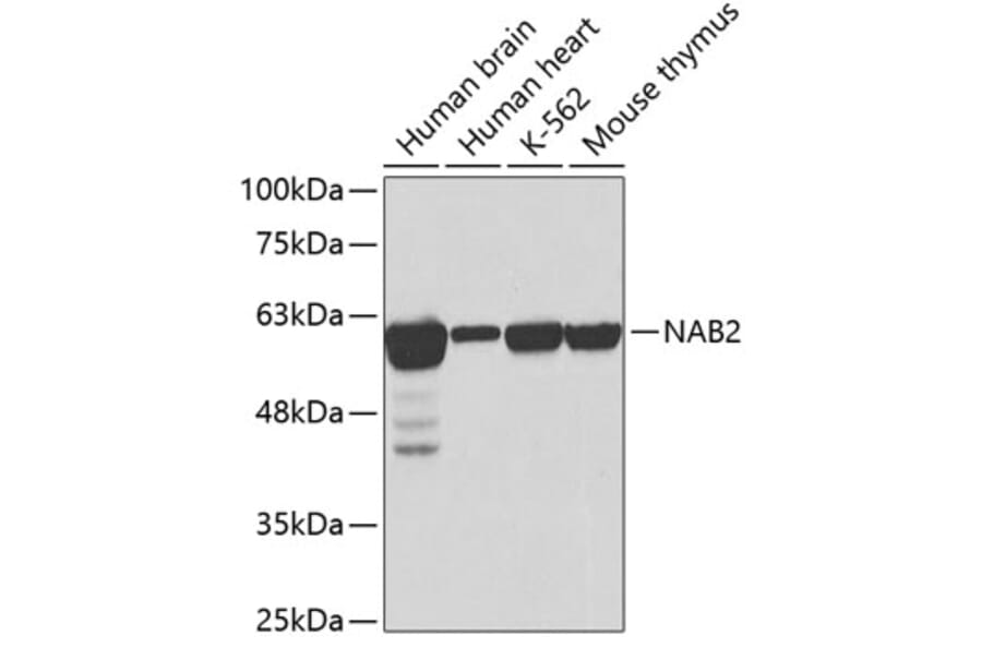 Western Blot - Anti-NAB2 Antibody (A2266) - Antibodies.com