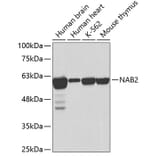 Western Blot - Anti-NAB2 Antibody (A2266) - Antibodies.com